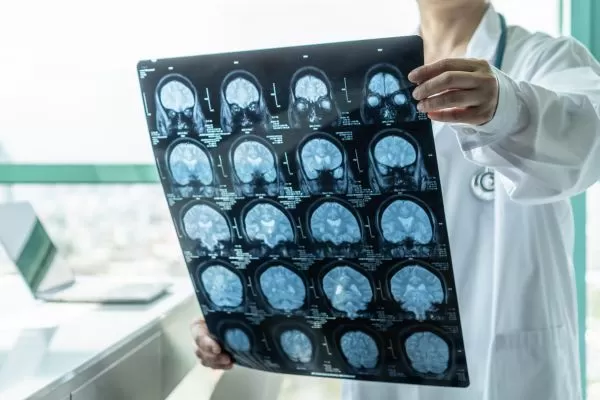 radiologist-viewing-MRI-images-of-brain